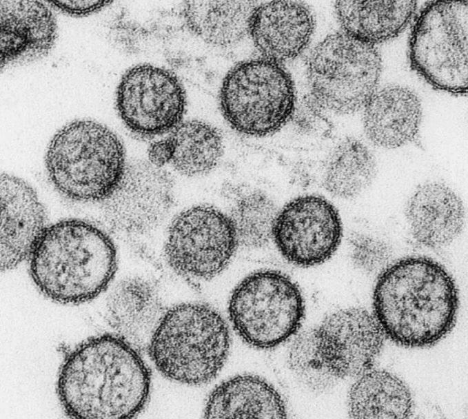 After the Coronavirus Havoc, a new virus called hantavirus kills a man in china